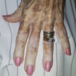 Nurse takes photo of old lady’s hand – then sees detail in the picture that has the internet exploding