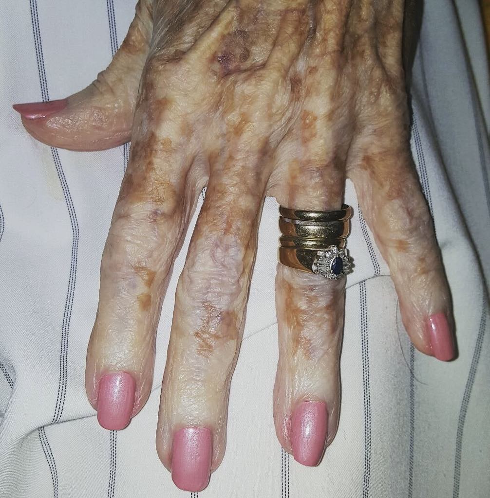 Nurse takes photo of old lady’s hand – then sees detail in the picture that has the internet exploding