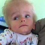 Dima, the child thrown by the mother like garbage! His parents didn’t even want to see him at birth because he looked too weird, they abandoned him at the first opportunity. But a few years later, something miraculous happened: