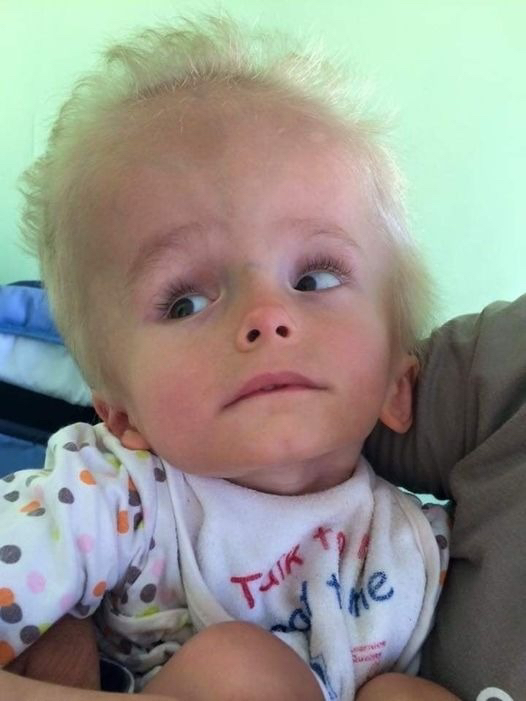 Dima, the child thrown by the mother like garbage! His parents didn’t even want to see him at birth because he looked too weird, they abandoned him at the first opportunity. But a few years later, something miraculous happened: