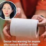 Doctor has warning for anyone who notices bubbles in their urine when they go to the toilet