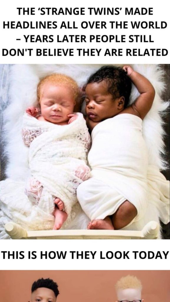 Rare Miracle: Mother Gives Birth to Black and White Twin Boys!