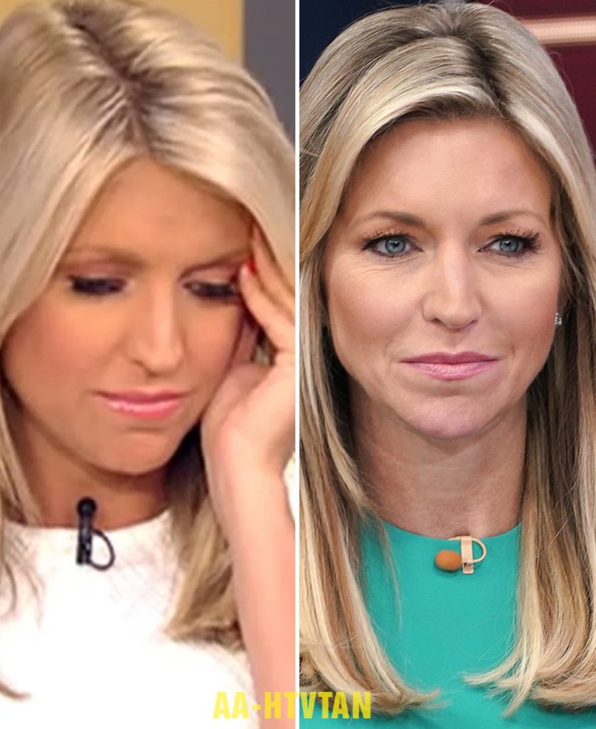 Fox News’ Ainsley Earhardt: A Remarkable Transformation