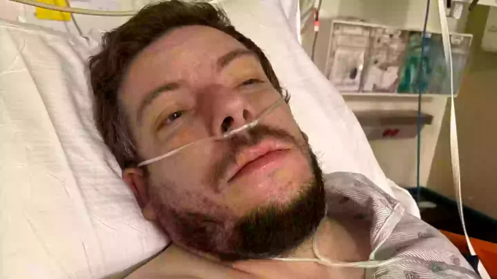 Man suffers major stroke and ‘nearly dies’ after a sneeze shockingly ruptured a neck artery