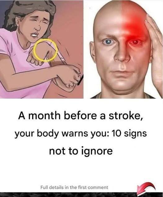 10 Early Warning Signs of a Stroke to Watch for