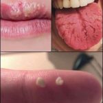 BE CAREFUL, if you get these bruises on your body, it means you have Ca…see more